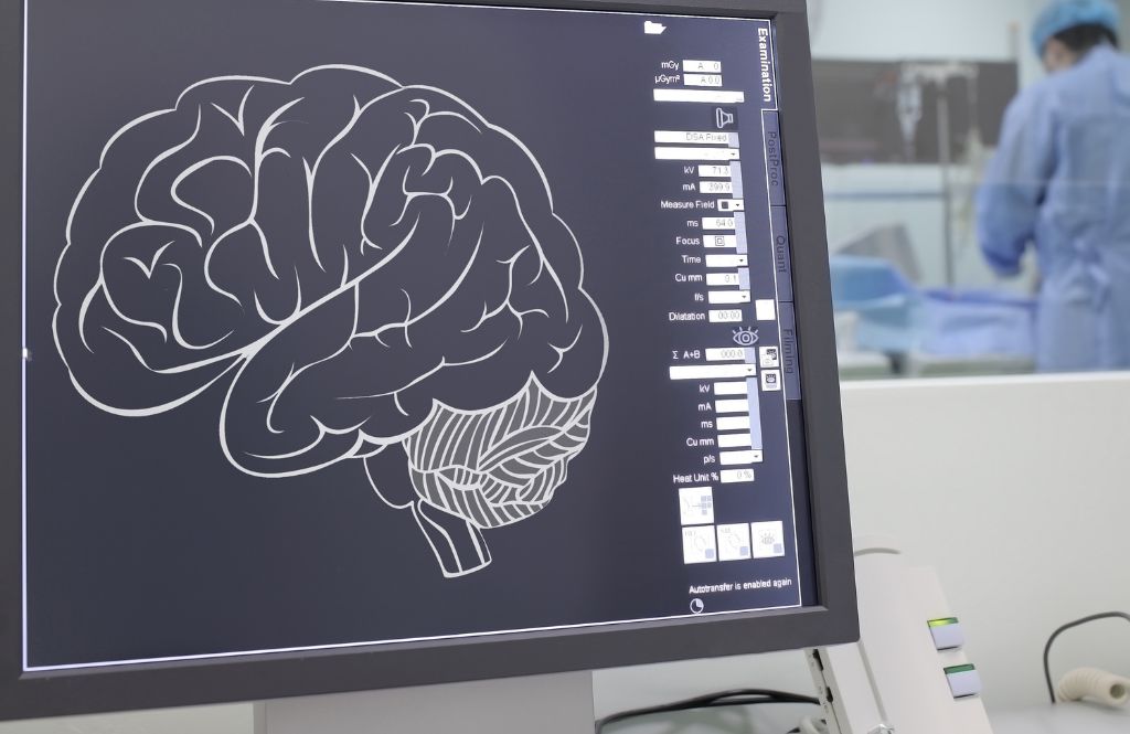 Neuro camp and stroke unit