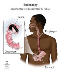 Endoscopy & GI Procedures